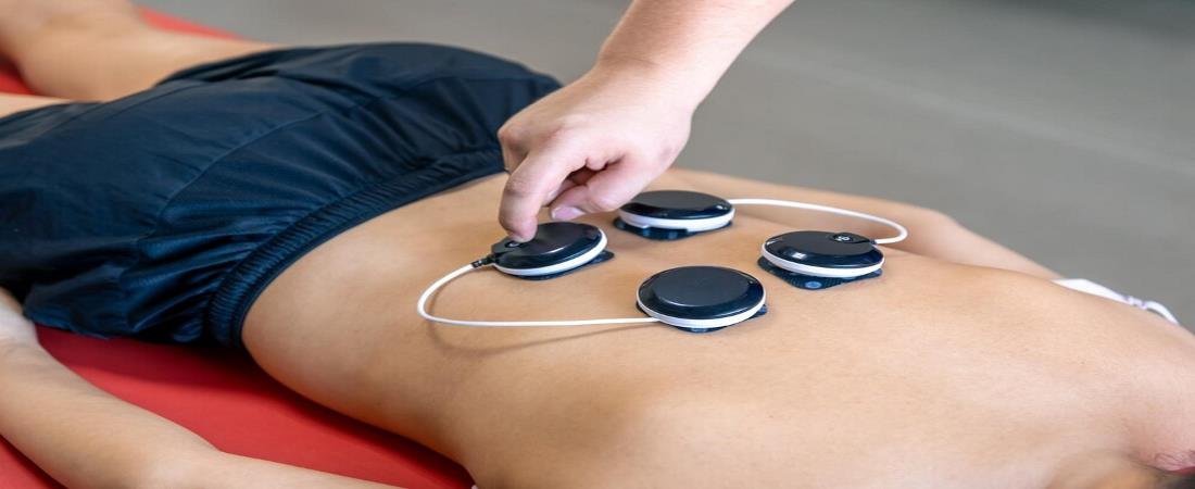 Dry Needling